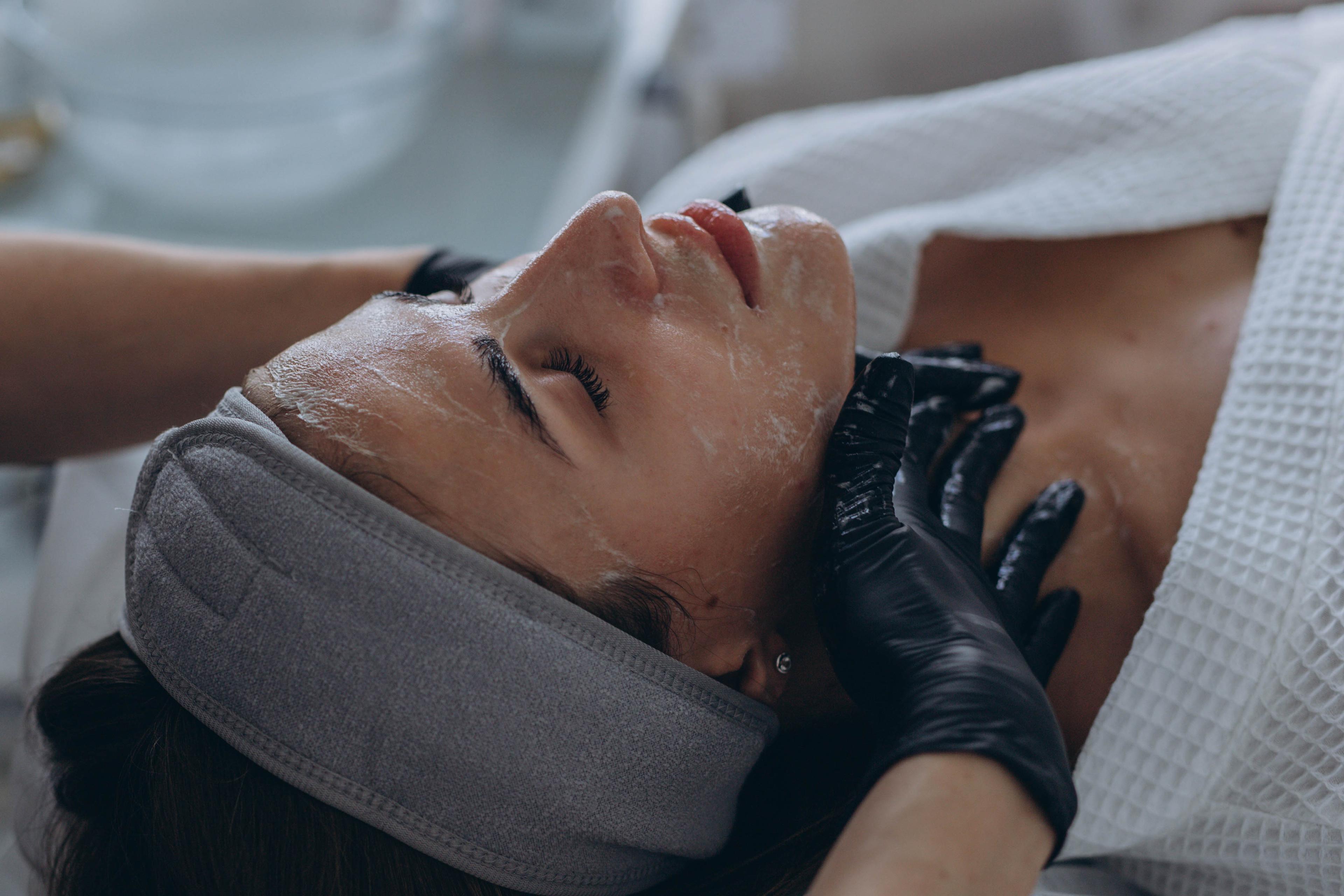 Chemical Peels result 1
