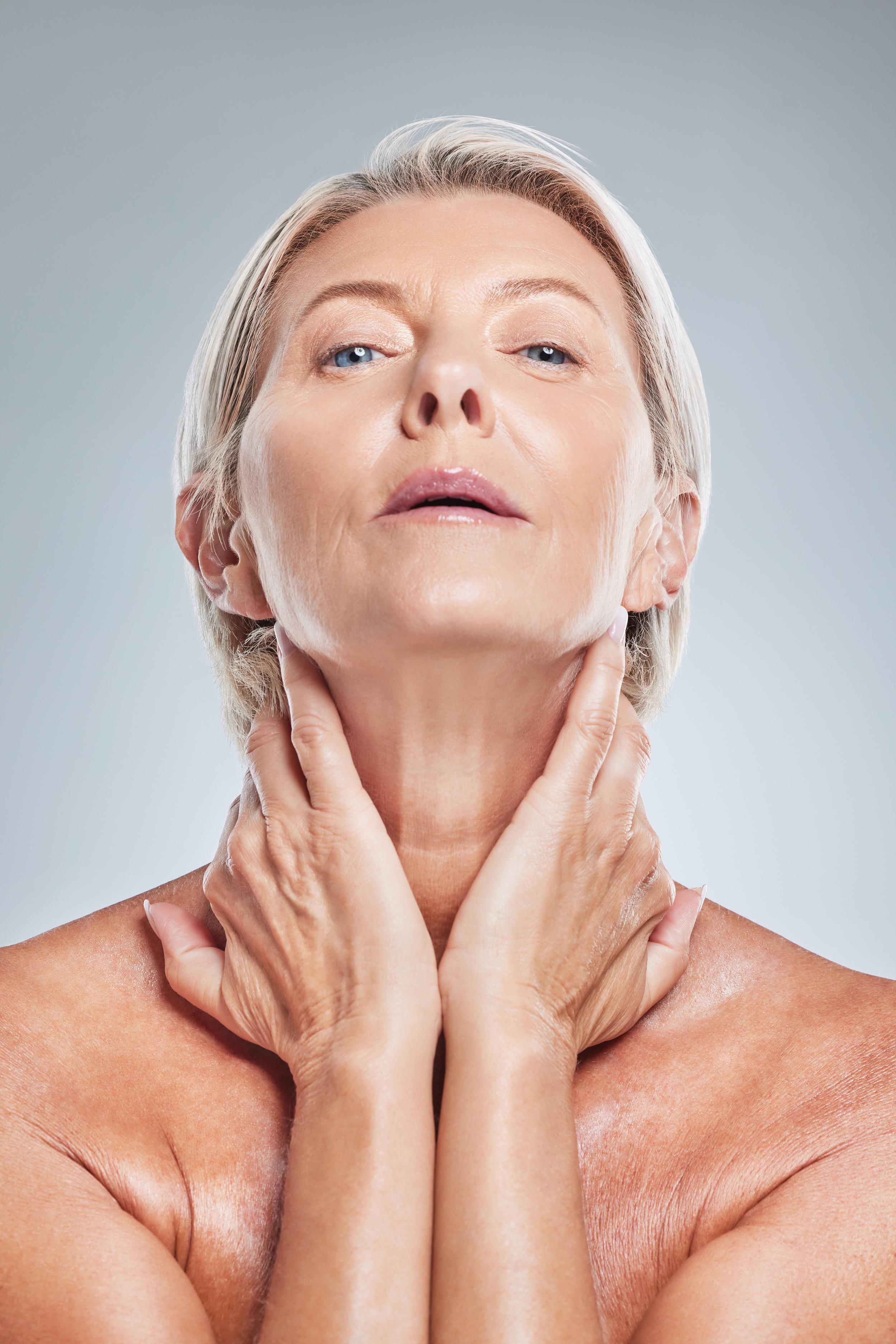 Fibroblast Skin Tightening result 1